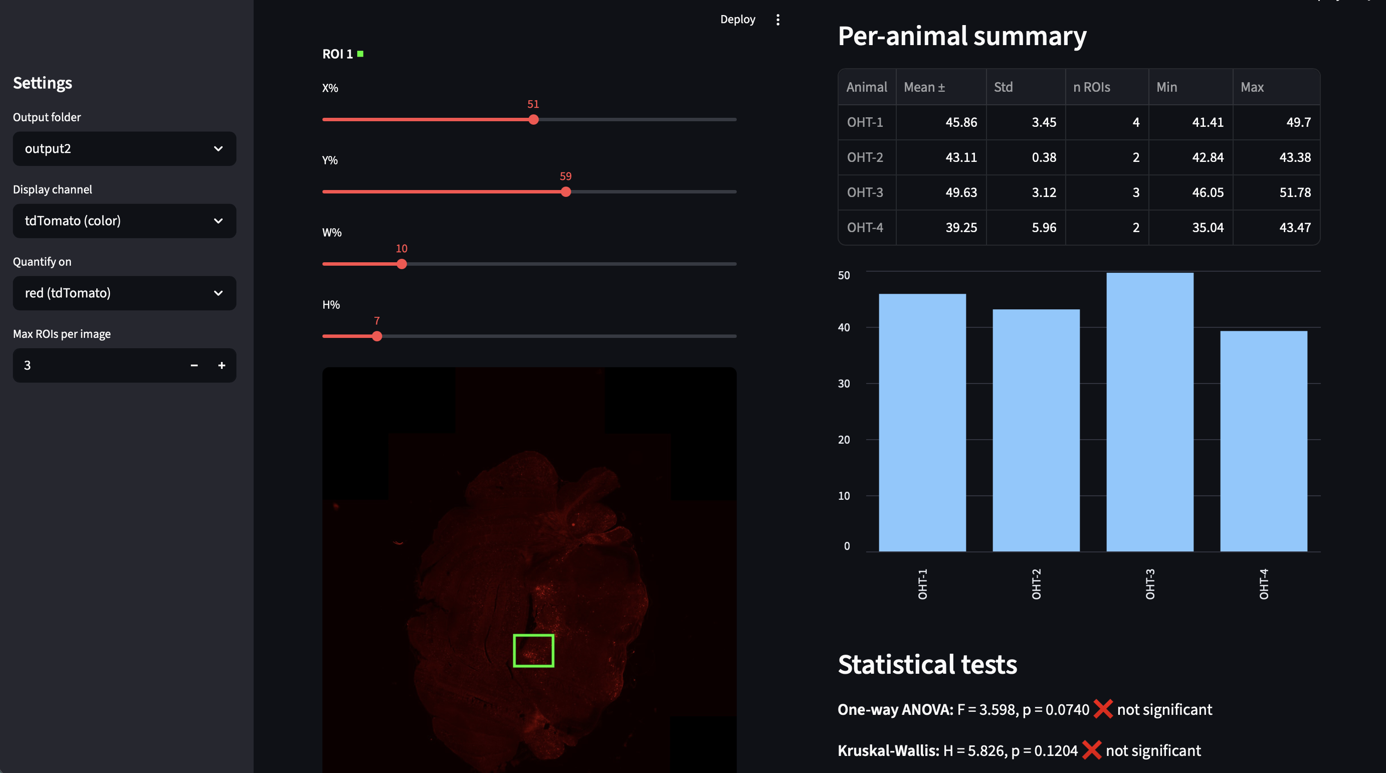 Histology ROI Quantification app — Streamlit interface showing tdTomato fluorescence brain section with ROI selection and per-animal expression summary with ANOVA statistics